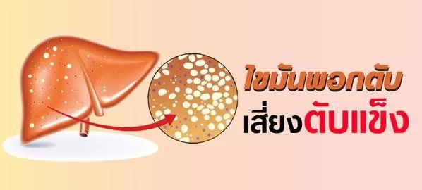 ไขมันพอกตับ ตับแข็ง ตับอักเสบ